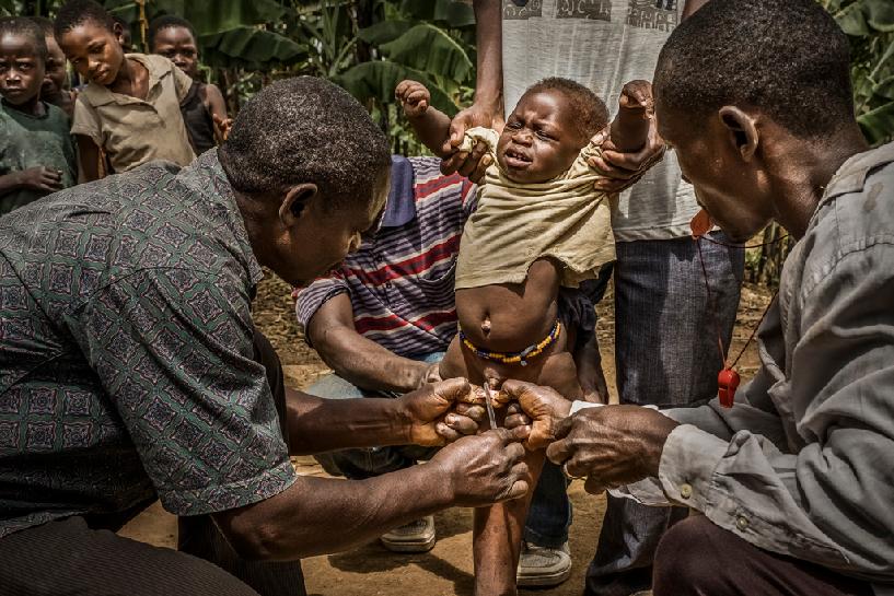 乌干达割礼 Uganda circumcision 宋艺兰/NANCY SONG